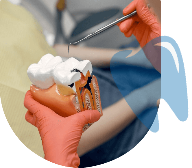 What Rootcanal